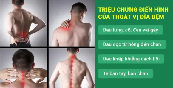 Thoát Vị Đĩa Đệm: Nhận Biết Triệu Chứng Sớm Và Giải Pháp Phục Hồi Tại Phụng Tiên Spa